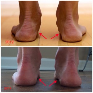 foot_arch_improvement_minimal_trrainer