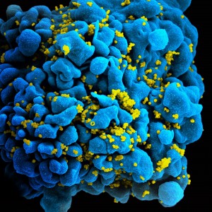 HIV infected t-cell